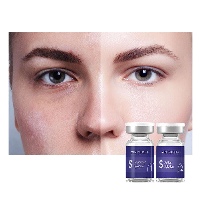 New Arrival Exosome S Injectable Skinbooster
