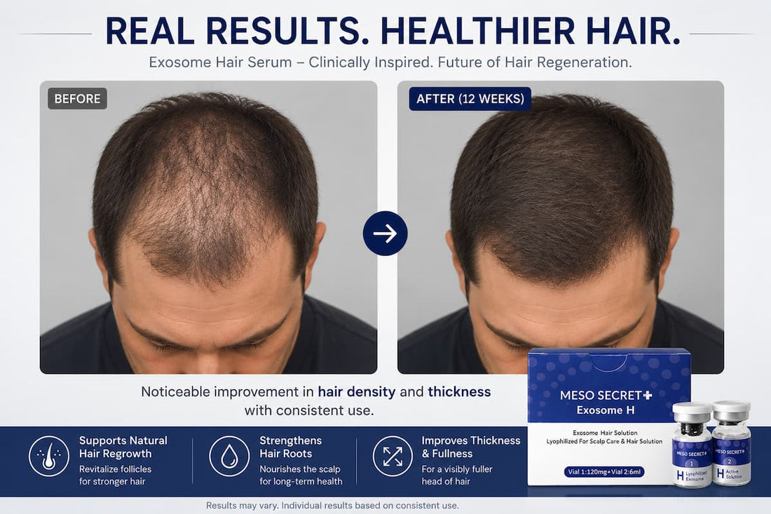 How to Use Exosome Hair Serum: The Two-Bottle System Explained