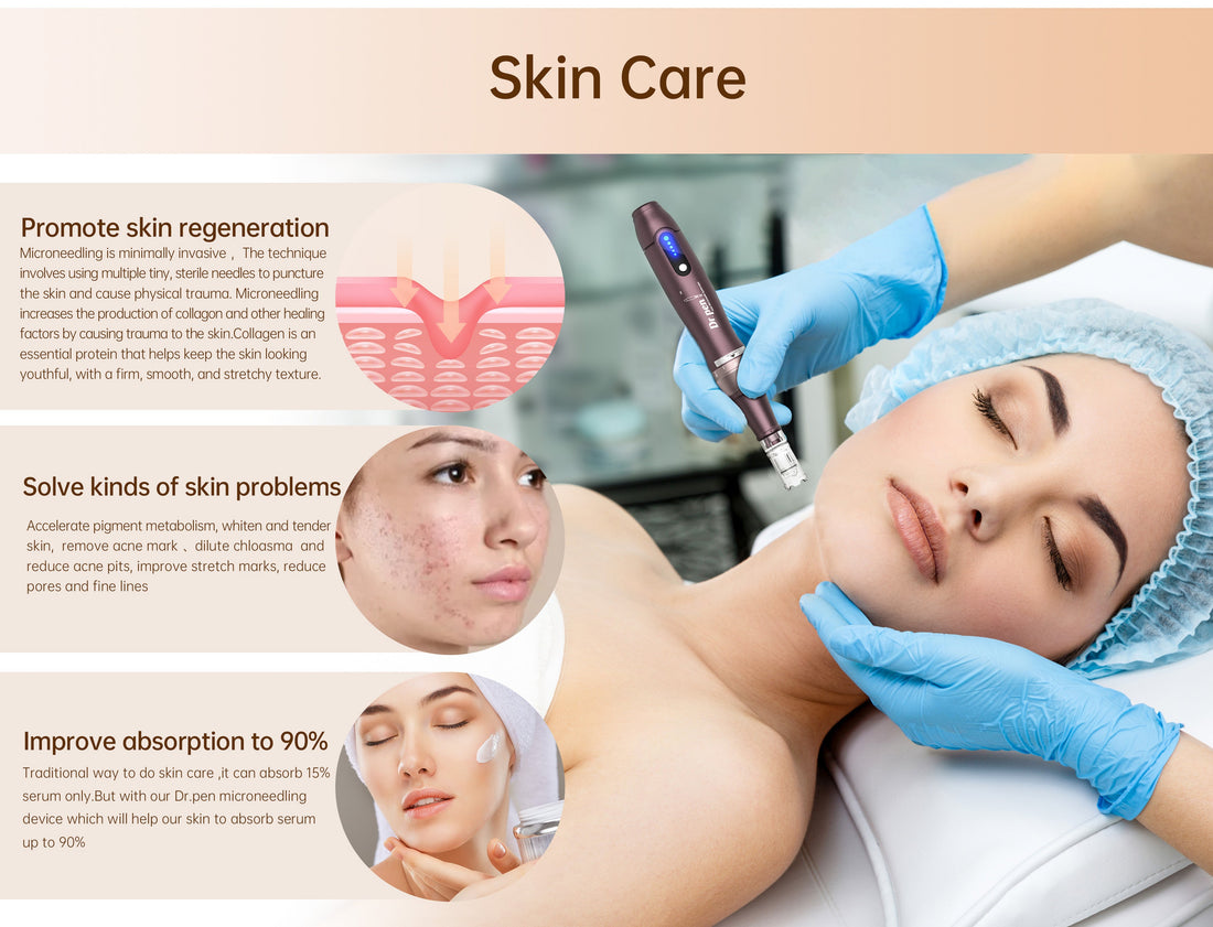 How to Treat Acne Scars at Home: The Ultimate Dr.pen Microneedling Guide