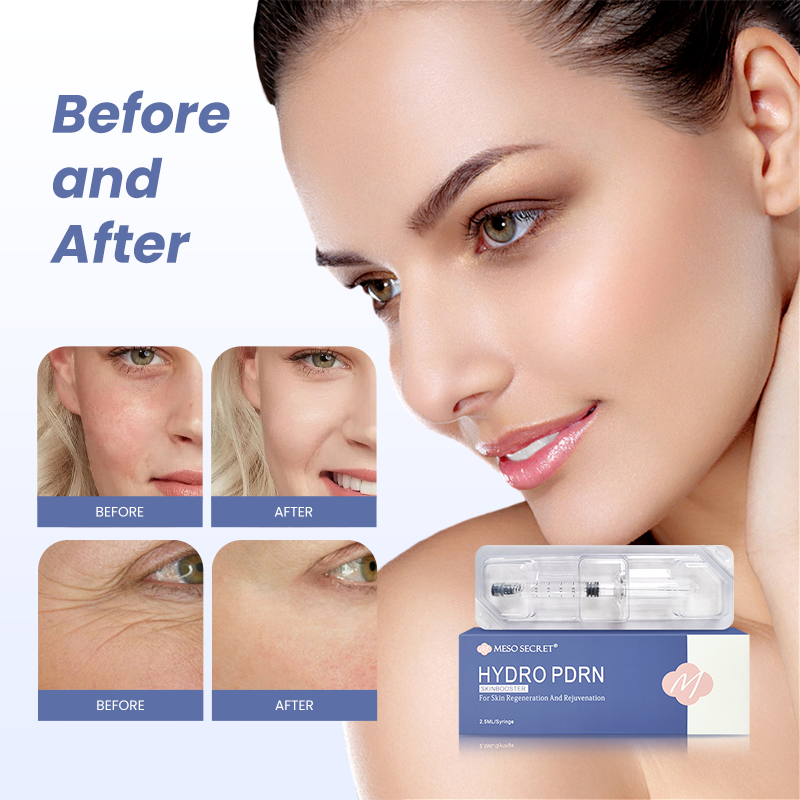Hydro PDRN Skinbooster Meso Secret 2.5ml/syringe