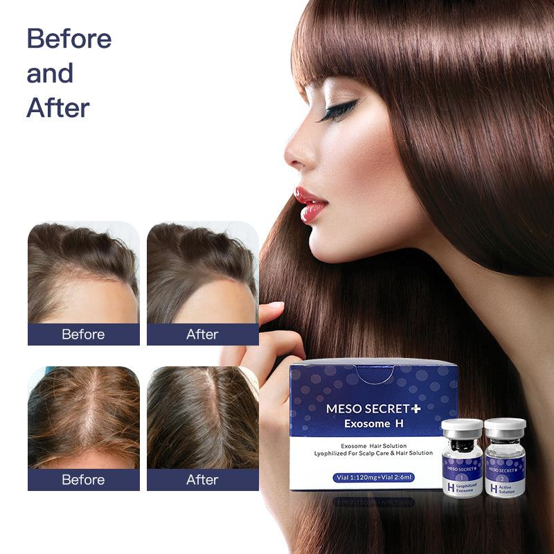 Exosome hair serum hair density and thinning results