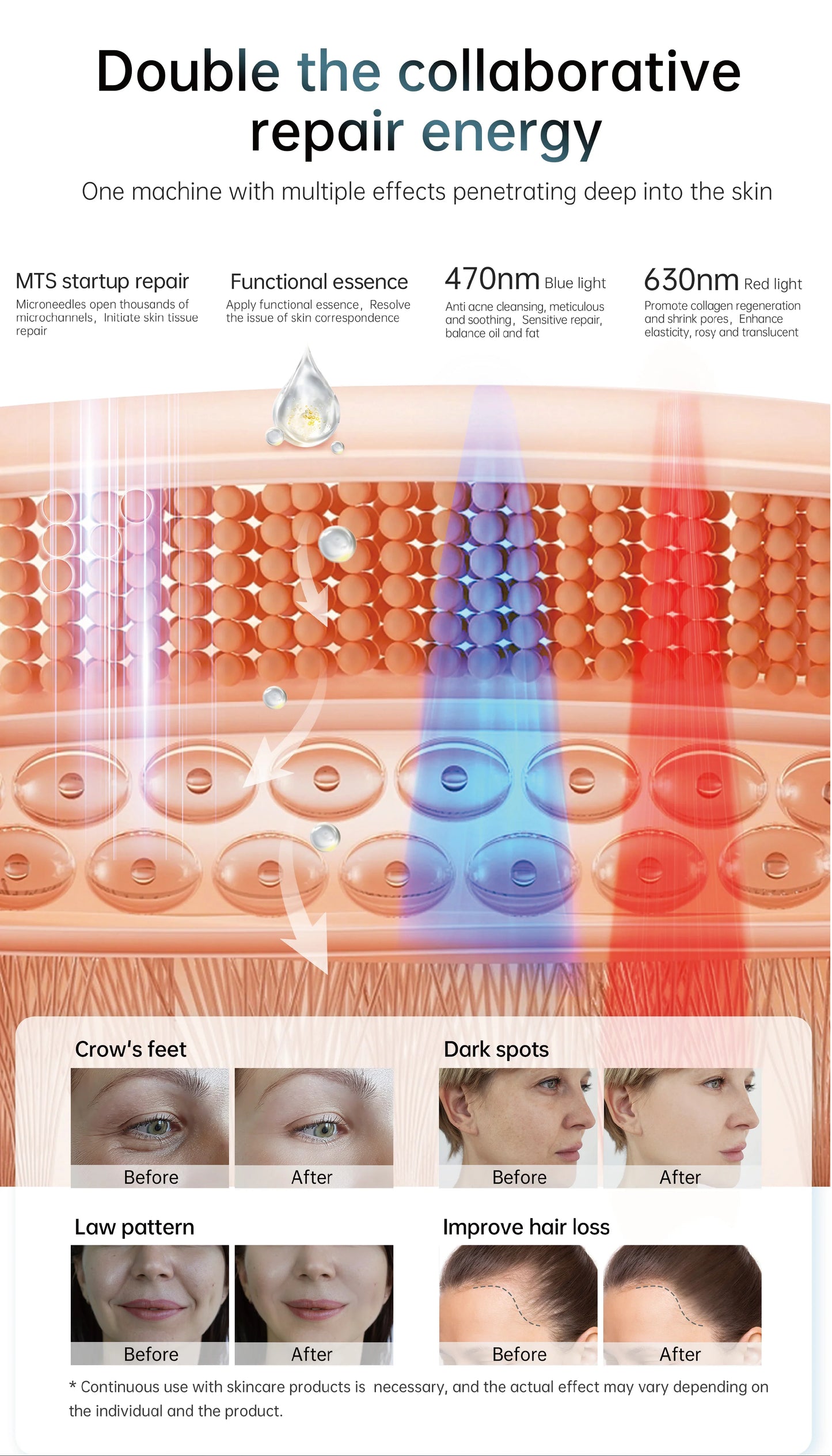 NEW Hydra Pen H6 Advanced Microneedling Pen